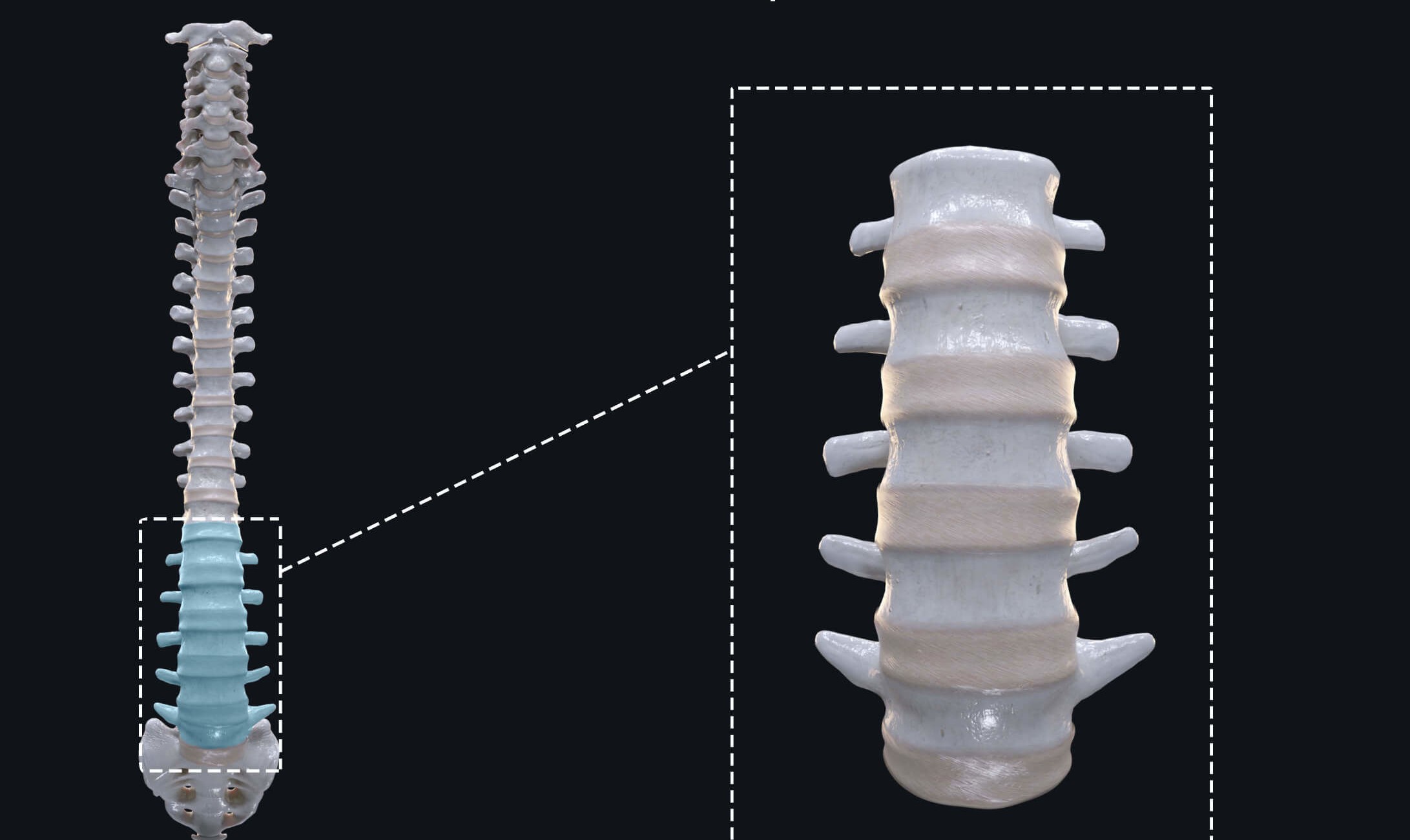 Lumbar Spine Treatment in Greater Noida