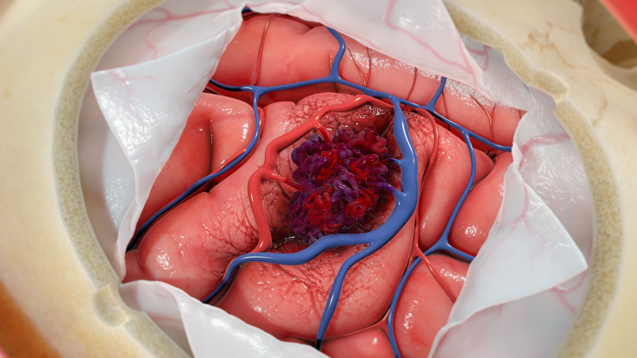 Vascular Surgery Treatment in Greater Noida