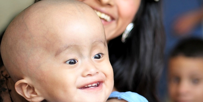 Hydrocephalus Treatment in Greater Noida
