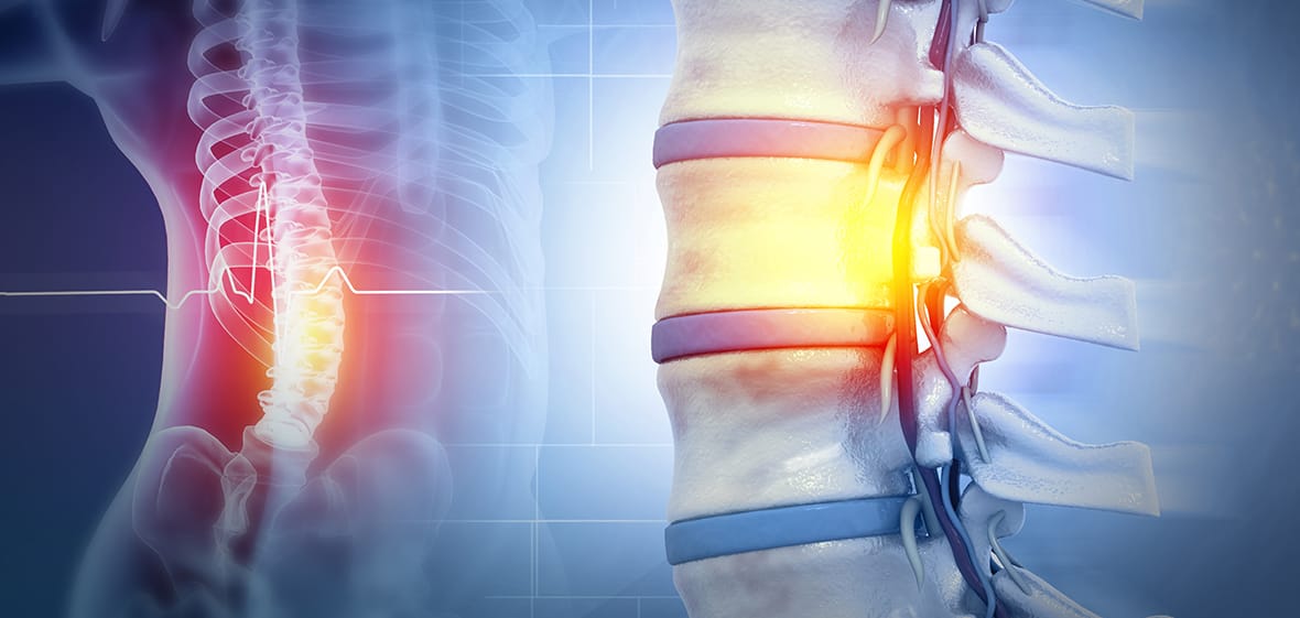 Spine Specialist in Greater Noida